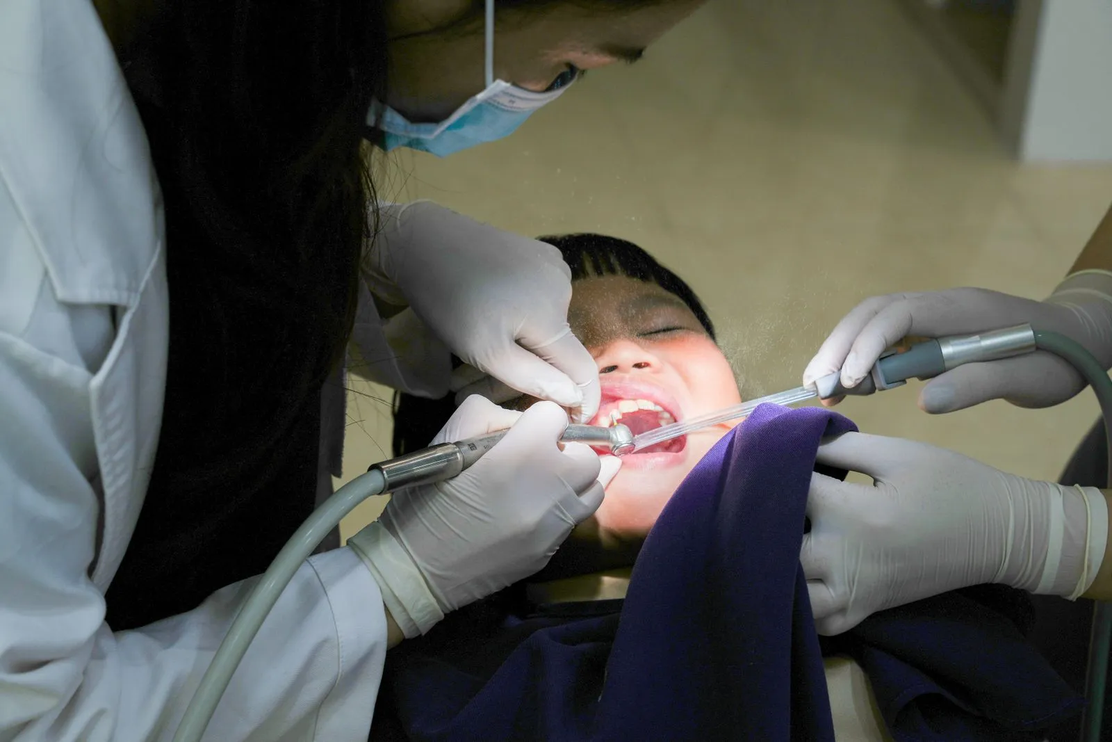 How to Handle a Knocked-Out Baby Tooth
